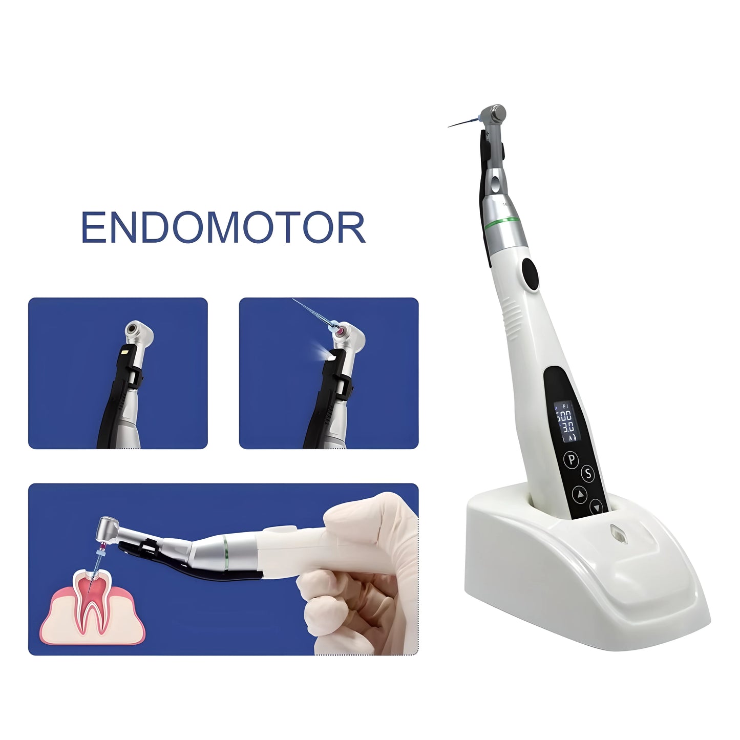 TOSI Dental Wireless Endo Motor Smart With LED Lamp 16:1  Reduction Contra Angle 7 Program Root Canal Endodontic Instrument